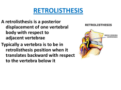 RETROLISTHESIS