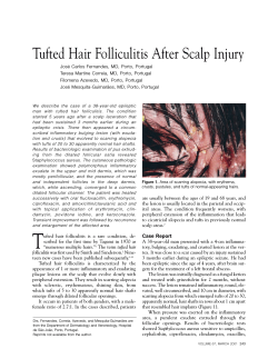 Tufted Hair Folliculitis After Scalp Injury