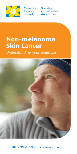 Non-melanoma Skin Cancer Understanding your diagnosis