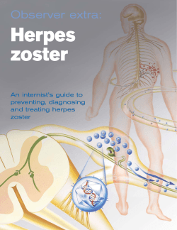 Herpes zoster Observer extra: An internist’s guide to