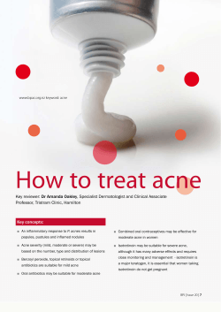 How to treat acne