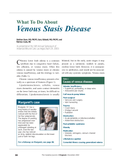 Venous Stasis Disease C What To Do About