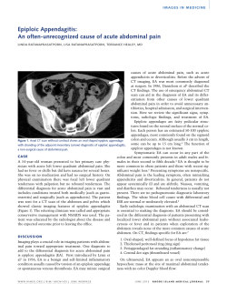 Epiploic Appendagitis: An often-unrecognized cause of acute abdominal pain
