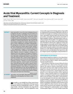 acute viral myocarditis: current concepts in diagnosis and treatment reviews