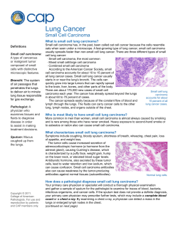 Lung Cancer Small Cell Carcinoma What is small cell lung carcinoma?