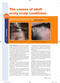 The causes of adult scaly scalp conditions