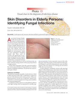 A Skin Disorders in Elderly Persons: Identifying Fungal Infections Photo