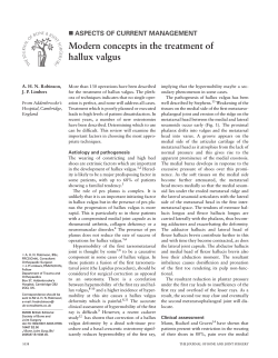 Modern concepts in the treatment of hallux valgus &#34;