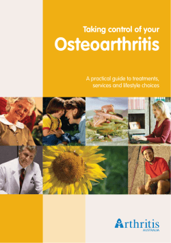 Osteoarthritis Taking control of your A practical guide to treatments,
