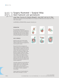 Surgery Illustrated – Surgical Atlas Adult hydrocele and spermatocele