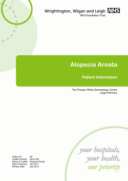 Alopecia Areata Patient Information