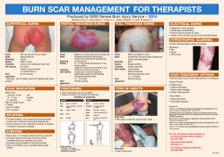 BURN SCAR MANAGEMENT FOR THERAPISTS SUPERFICIAL BURNS PARTIAL THICKNESS BURNS FULL THICKNESS BURNS