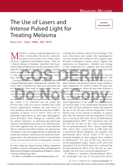 M The Use of Lasers and Intense Pulsed Light for Treating Melasma
