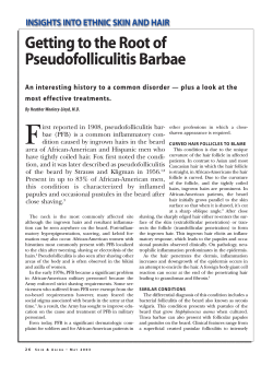 Getting to the Root of Pseudofolliculitis Barbae
