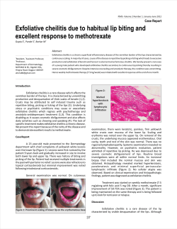 Exfoliative cheilitis due to habitual lip biting and Case Report Abstract