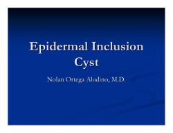 Epidermal Inclusion Cyst Nolan Ortega Aludino, M.D.