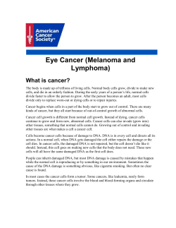 Eye Cancer (Melanoma and Lymphoma) What is cancer?