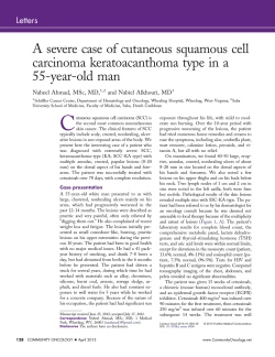 A severe case of cutaneous squamous cell 55-year-old man