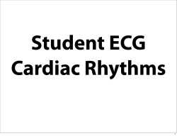 Student ECG Cardiac Rhythms 1