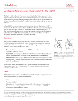 .org Developmental Dislocation (Dysplasia) of the Hip (DDH)