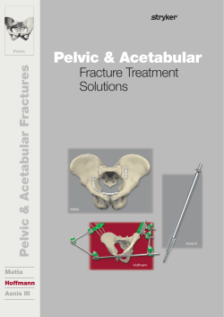 Pelvic &amp; Acetabular Fracture Treatment Solutions s