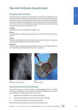 Hip Joint Arthrosis (coxarthrosis) Anatomy and Functions