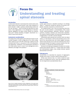 Understanding and treating spinal stenosis Focus On Introduction
