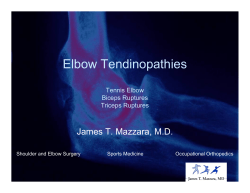 Elbow Tendinopathies James T. Mazzara, M.D. Tennis Elbow Biceps Ruptures