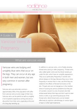 Varicose Veins &amp; Pregnancy  A Guide to
