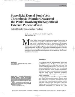 Superficial Dorsal Penile Vein Thrombosis (Mondor Disease of External Pudendal Vein