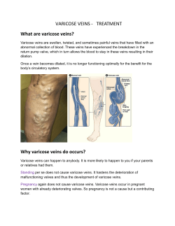 VARICOSE VEINS -   TREATMENT What are varicose veins?