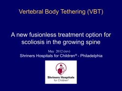 Vertebral Body Tethering (VBT) A new fusionless treatment option for