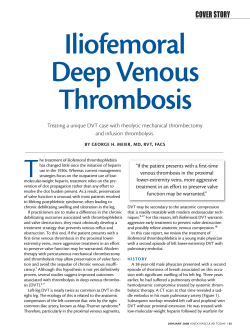 Iliofemoral Deep Venous Thrombosis T