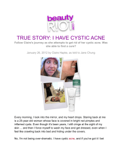 TRUE STORY: I HAVE CYSTIC ACNE