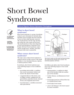 Short Bowel Syndrome What is short bowel syndrome?