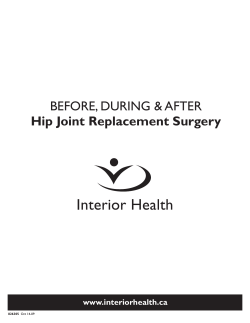 BEFORE, DURING &amp; AFTER Hip Joint Replacement Surgery www.interiorhealth.ca 826305