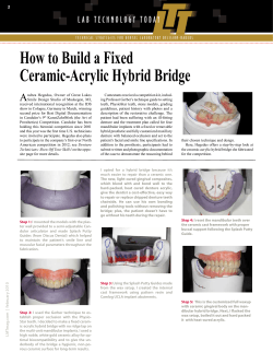 How to Build a Fixed Ceramic-Acrylic Hybrid Bridge A 2