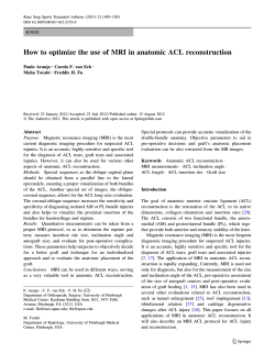 How to optimize the use of MRI in anatomic ACL... K N E E Paulo Araujo Carola F. van Eck