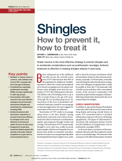 Shingles How to prevent it, how to treat it