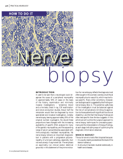 biopsy Nerve HOW TO DO IT
