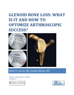 GLENOID	BONE	LOSS:	WHAT IS	IT	AND	HOW	TO OPTIMIZE	ARTHROSCOPIC