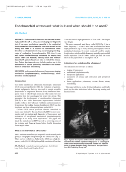 Endobronchial ultrasound: what is it and when should it be... ARL Medford