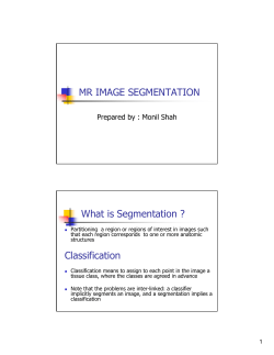 MR IMAGE SEGMENTATION What is Segmentation ? Prepared by : Monil Shah