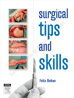 tips skills surgical and