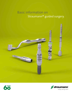 Basic information on  Straumann® guided surgery. X