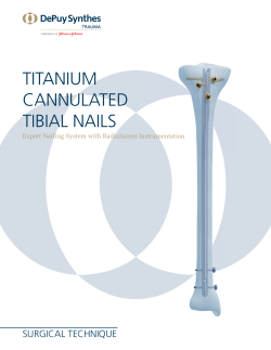 TITANIUM CANNULATED TIBIAL NAILS SUrgICAL TEChNIqUE