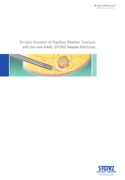En-bloc Excision of Papillary Bladder Tumours
