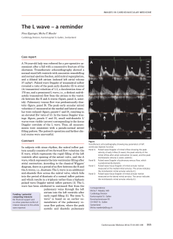 The L wave – a reminder Case report