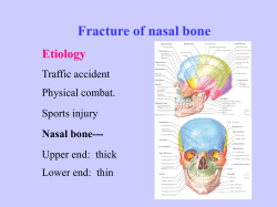 Fracture of nasal bone Etiology Traffic accident Physical combat.