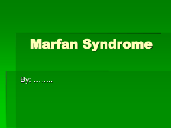 Marfan Syndrome By: ……..